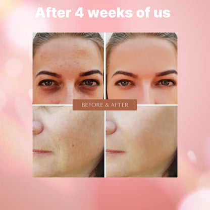 ELT 3-in-1 Triple Captuls Face Serum with Rose PDRN, Taurin, Niacinamide, Vitamin C & CoQ10, Hydrating & Moisturizing, Skin Restoration, Korean Skincare 30ml (1.01 FL.OZ.)