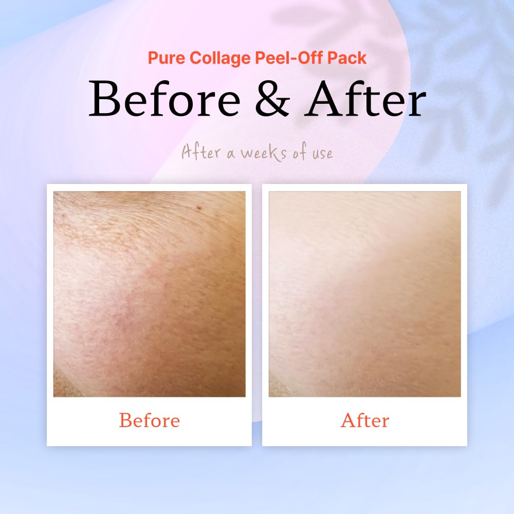 ELT Pure Collagen Glowing Peel Off Pack 2.02 fl.oz. (60ml)